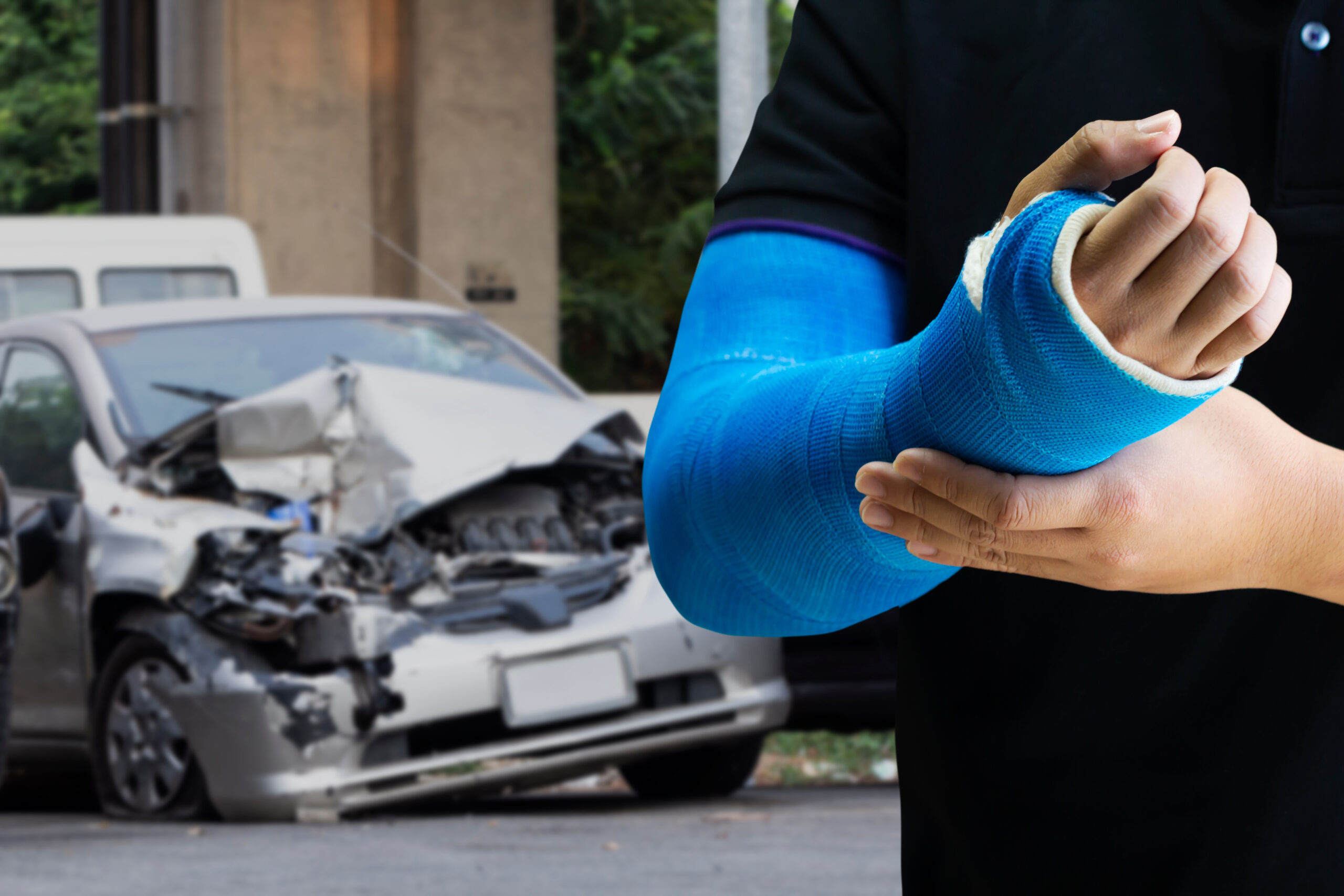 Person with a cast standing in front of a car accident.