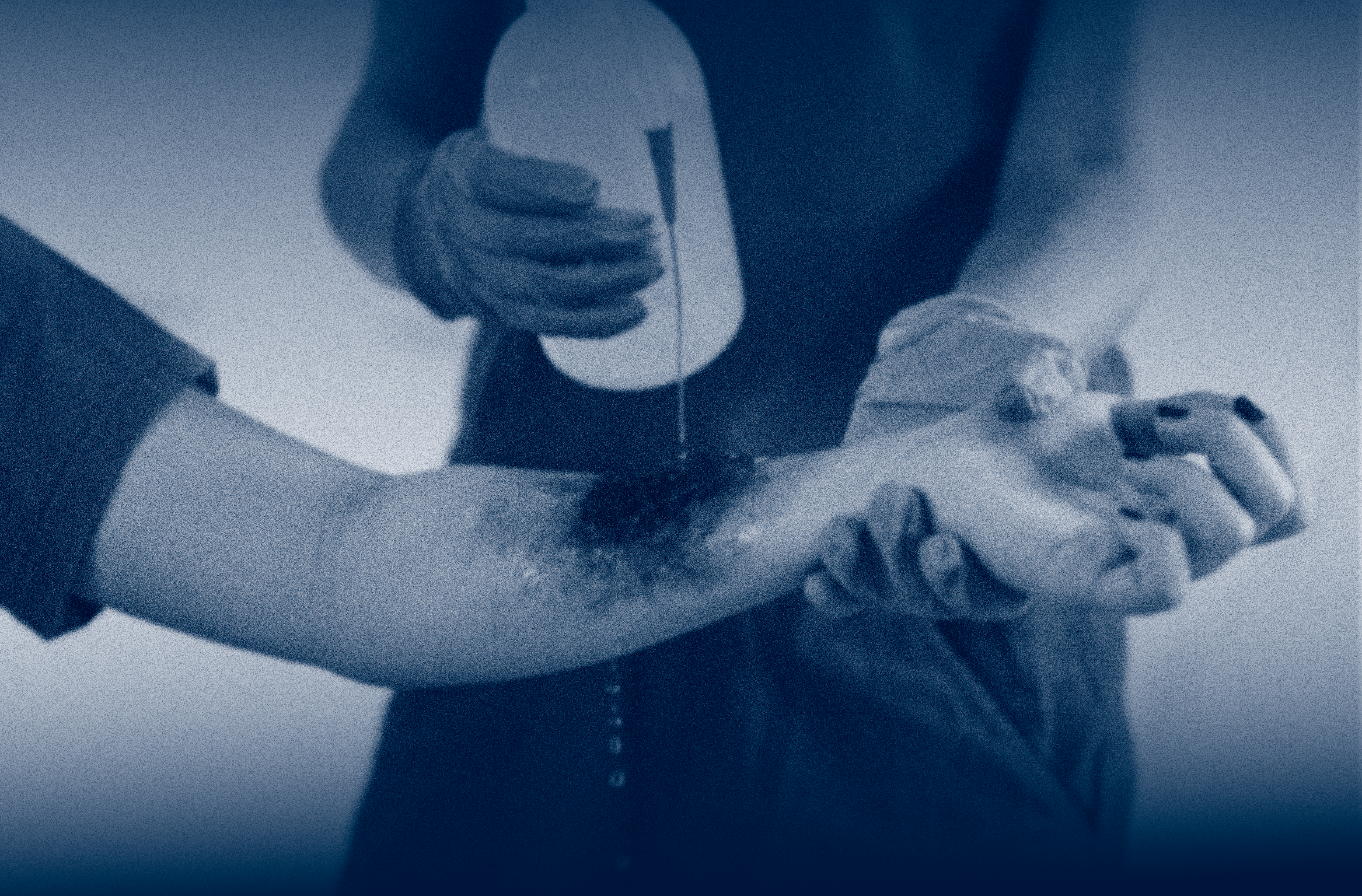 Burn Injuries in Rental Properties: When Landlords Are Responsible 